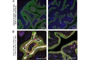 Chronic CFT073 cystitis causes bladder remodeling phenotypes that persist after antibiotic therapy.