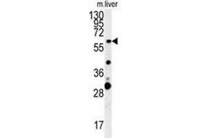 ZCCHC5 Antibody (N-term) western blot analysis in mouse liver tissue lysates (15 µg/lane). (ZCCHC5 anticorps  (N-Term))