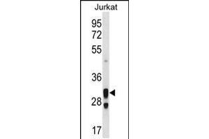 Western blot analysis in Jurkat cell line lysates (35ug/lane). (ACER1 anticorps  (C-Term))