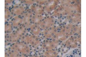 DAB staining on IHC-P; Samples: Mouse Kidney Tissue (EIF2AK2 anticorps  (AA 205-495))