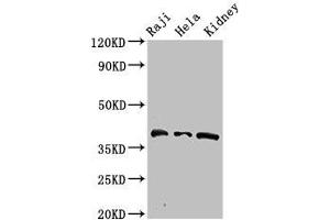Western Blot Positive WB detected in: Raji whole cell lysate, Hela whole cell lysate, Mouse kidney tissue All lanes: RFC4 antibody at 2.