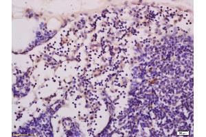 Formalin-fixed and paraffin embedded rat pancreas tissue labeled with Anti-cGMP Polyclonal Antibody, Unconjugated (ABIN750733) at 1:400, followed by conjugation to the secondary antibody and DAB staining
