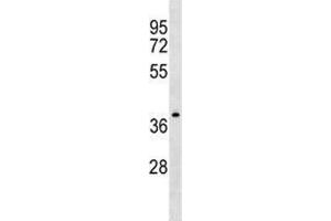 NDRG4 antibody western blot analysis in CEM lysate. (NDRG4 anticorps  (AA 193-220))