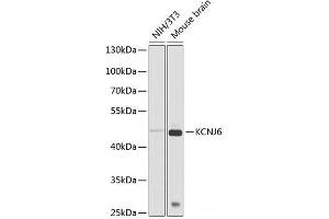 Western blot analysis of extracts of various cell lines using KCNJ6 Polyclonal Antibody at dilution of 1:1000. (KCNJ6 anticorps)