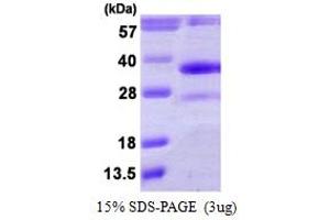 SDS-PAGE (SDS) image for Dehydrogenase/reductase (SDR Family) Member 4 (DHRS4) (AA 1-278) protein (His tag) (ABIN6386857)