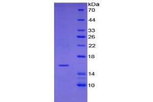 WB of Protein Standard: different control antibodies  against Highly purified E.