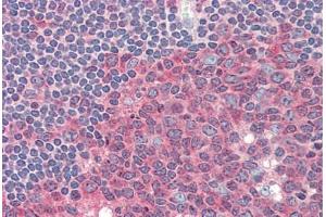 Human Tonsil (formalin-fixed, paraffin-embedded) stained with PKM2 antibody ABIN337171 at 1:100 followed by biotinylated goat anti-rabbit IgG secondary antibody ABIN481713, alkaline phosphatase-streptavidin and chromogen. (Pyruvate Kinase, Muscle (PKM) anticorps)