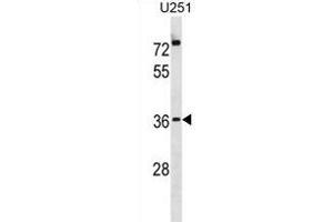 POPD3 Antibody (C-term) (ABIN1881674 and ABIN2838985) western blot analysis in  cell line lysates (35 μg/lane). (POPDC3 anticorps  (C-Term))