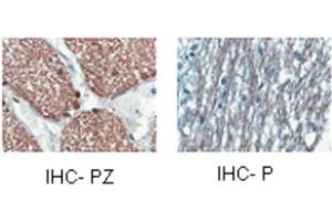 human optic nerve and spinal cord