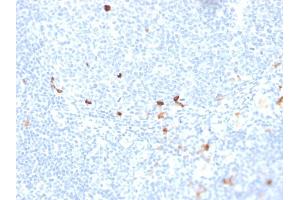Formalin-fixed, paraffin-embedded human tonsil stained with IgM Recombinant Mouse Monoclonal Antibody (rIGHM/1623). (Recombinant IGHM anticorps)