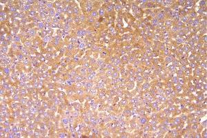 IHC analysis of Factor H/Cfh using anti-Factor H/Cfh antibody (ABIN7599985).