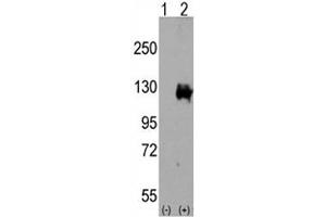 Western blot analysis of TRPM8 antibody and 293 cell lysate either nontransfected (Lane 1) or transiently transfected with the TRPM8 gene (2). (TRPM8 anticorps  (AA 1075-1104))