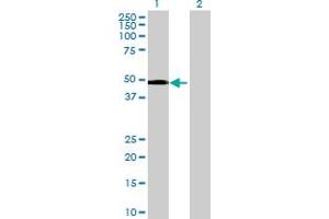 Western Blot analysis of SNRNP48 expression in transfected 293T cell line by SNRNP48 MaxPab polyclonal antibody. (SNRNP48 anticorps  (AA 1-339))