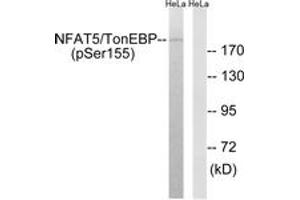 Western blot analysis of extracts from HeLa cells treated with forskolin 40nM 30', using NFAT5/TonEBP (Phospho-Ser155) Antibody. (NFAT5 anticorps  (pSer155))