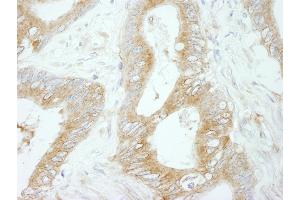 Immunohistochemistry (IHC) image for anti-Flightless I Homolog (FLII) (AA 425-475) antibody (ABIN7448968)