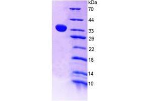 SDS-PAGE of Protein Standard from the Kit (Highly purified E. (ANGPTL4 Kit ELISA)