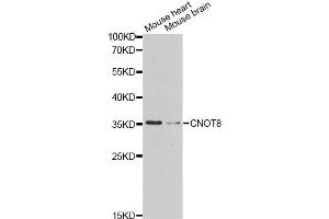 Western blot analysis of extracts of various cell lines, using CNOT8 Antibody. (CNOT8 anticorps)