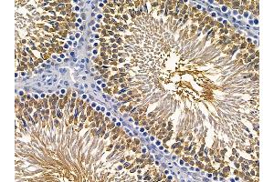 ABIN6257498 and ABIN6275600 at 1/100 staining rat testis tissue by IHC-P. (Sorting Nexin 1 anticorps  (Internal Region))