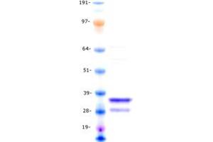 Validation with Western Blot