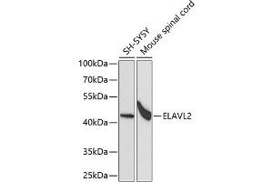 Western blot analysis of extracts of various cell lines, using EL antibody (ABIN6134649, ABIN6140114, ABIN6140116 and ABIN6221621) at 1:1000 dilution.