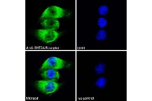ABIN1049520 Immunofluorescence analysis of paraformaldehyde fixed A549 cells, permeabilized with 0.