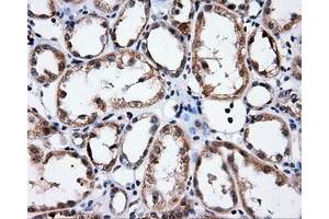 Immunohistochemistry (IHC) image for anti-Induced Myeloid Leukemia Cell Differentiation Protein Mcl-1 (MCL1) antibody (ABIN1499340)