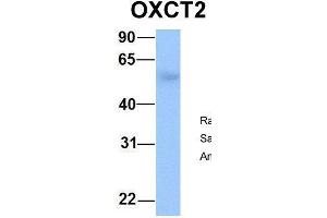 Host:  Rabbit  Target Name:  OXCT2  Sample Type:  Human Fetal Lung  Antibody Dilution:  1. (OXCT2 anticorps  (Middle Region))
