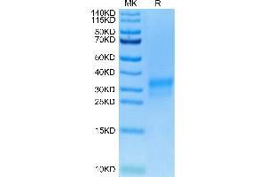 Biotinylated Human Her2 Domain 4 on Tris-Bis PAGE under reduced condition.