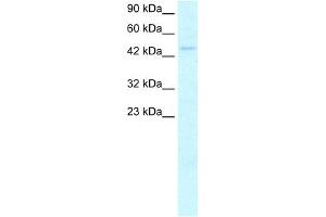 WB Suggested Anti-MYCN Antibody Titration:  2. (MYCN anticorps  (C-Term))