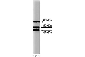 Western Blotting (WB) image for anti-SHC (Src Homology 2 Domain Containing) Transforming Protein 1 (SHC1) (AA 359-473) antibody (ABIN968229)