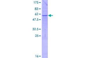 Image no. 1 for Palmitoyl-Protein Thioesterase 2 (PPT2) (AA 1-302) protein (GST tag) (ABIN1316096)