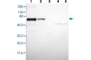 Western blot analysis of Lane 1: RT-4, Lane 2: U-251 MG, Lane 3: Human Plasma, Lane 4: Liver, Lane 5: Tonsil with CD2AP polyclonal antibody  at 1:250-1:500 dilution.