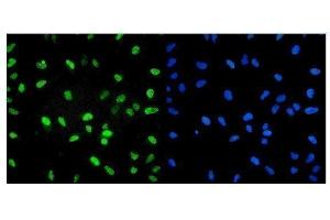 IF analysis of U2AF2 using anti-U2AF2 antibody (ABIN7600793). (U2AF2 anticorps  (AA 238-470))