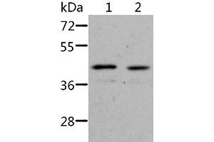 Western Blot analysis of Jurkat cell and Human fetal kidney tissue using NIF3L1 Polyclonal Antibody at dilution of 1:500 (NIF3L1 anticorps)