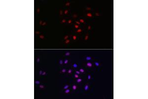 anti-Hepatoma-Derived Growth Factor (HDGF) antibody