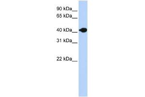 WB Suggested Anti-DNASE2B Antibody Titration:  0. (DNASE2B anticorps  (N-Term))