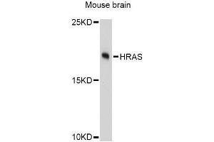 Western blot analysis of extracts of mouse brain, using HRAS Antibody. (HRAS anticorps  (AA 1-189))