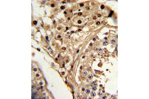 Immunohistochemistry (IHC) image for anti-Kruppel-Like Factor 6 (KLF6) antibody (ABIN3002701)