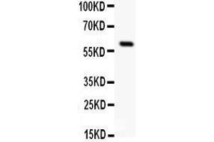 Anti-SSTR1 antibody, Western blotting All lanes: Anti SSTR1  at 0. (SSTR1 anticorps  (C-Term))