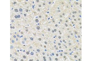 Immunohistochemistry of paraffin-embedded Mouse liver using CD98 Polyclonal Antibody at dilution of 1:100 (40x lens).
