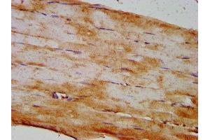 IHC image of ABIN7173972 diluted at 1:400 and staining in paraffin-embedded human skeletal muscle tissue performed on a Leica BondTM system.