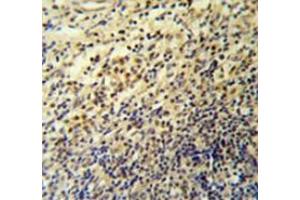 Immunohistochemistry analysis in tonsil (Formalin-fixed, Paraffin-embedded) using PLA2G7 Antibody , followed by peroxidase conjugated secondary antibody and DAB staining. (PLA2G7 anticorps  (Middle Region))