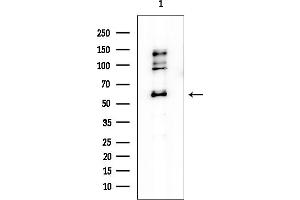 Western blot analysis of lysates from Mouse testis, using Src Mouse Monoclonal Antibody at 1/1000 dilution.