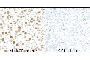 Immunohistochemistry (IHC) image for anti-Minichromosome Maintenance Complex Component 2 (MCM2) (pSer53) antibody (ABIN7449430) (Recombinant MCM2 anticorps  (pSer53))