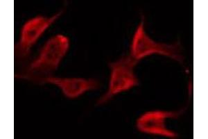 ABIN6272383 staining Hela by IF/ICC. (PDE4B/C/D anticorps)