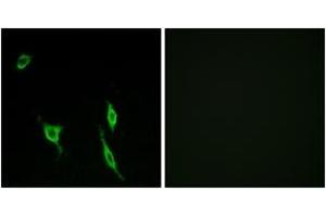 Immunofluorescence analysis of LOVO cells, using DCC Antibody. (DCC anticorps  (AA 441-490))