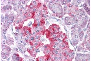 Human Pancreas: Formalin-Fixed, Paraffin-Embedded (FFPE)