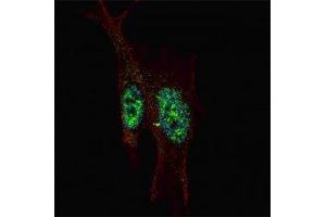 Fluorescent confocal image of SY5Y cells stained with STAT-3 antibody at 1:200.