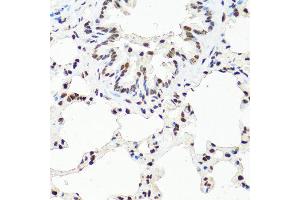 Immunohistochemistry of paraffin-embedded rat lung using TET2 antibody at dilution of 1:100 (40x lens).