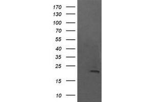 Image no. 1 for anti-NFKB Inhibitor Interacting Ras-Like 1 (NKIRAS1) antibody (ABIN1499741) (NKIRAS1 anticorps)